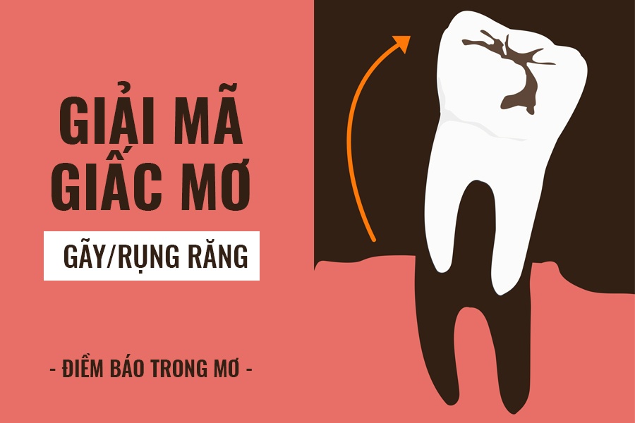 Mơ Thấy Rụng Răng Là Điềm Gì? Giải Mã Ý Nghĩa Và Con Số May Mắn Chuẩn Xác - rilohe
